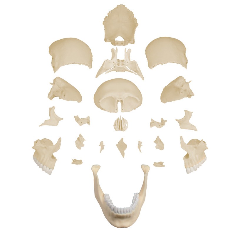 Erler-Zimmer Osteopathic Skull Model (22 Parts)